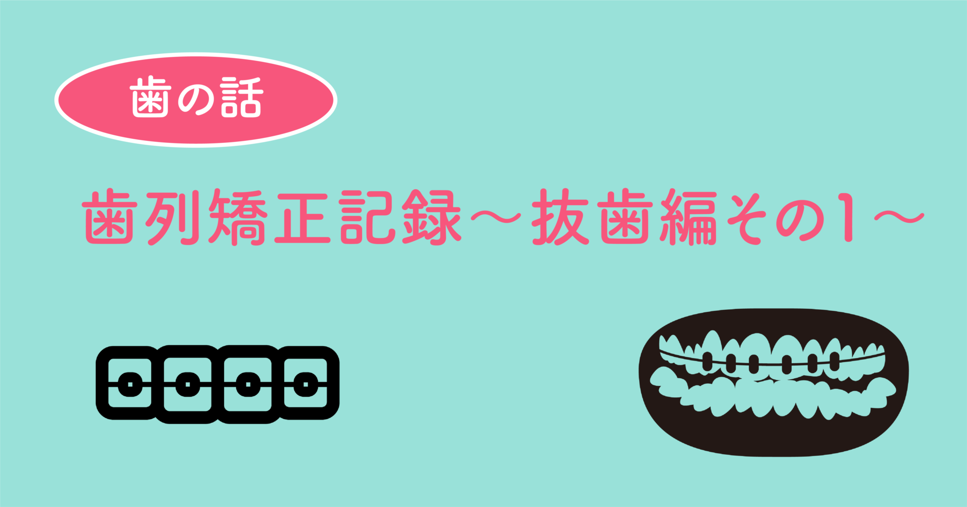 歯列矯正記録〜抜歯編その1〜