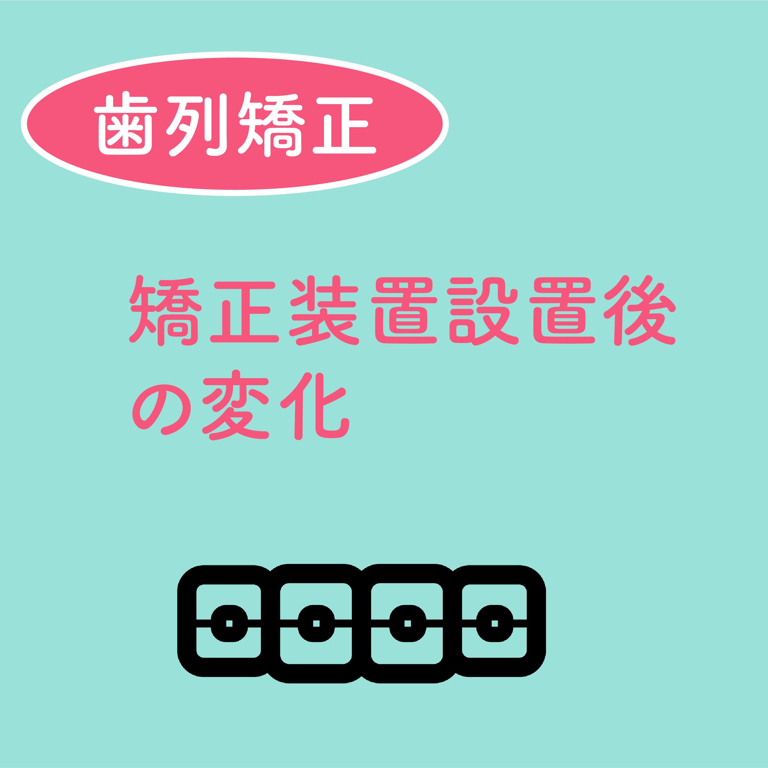 矯正装置取り付け後の変化